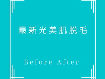 エレヌイ(ELENUI)/