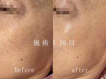 マシェリ(macherie)/