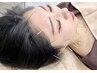 【U24学割】美容鍼体験☆垢抜け肌＆小顔！肌荒れ・むくみ・フェイスライン◎