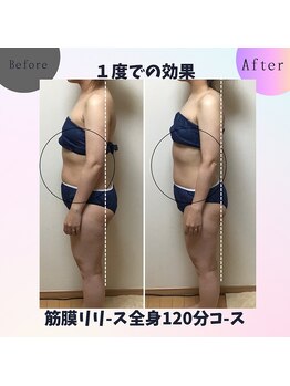 アルディート(Ardito)/筋膜リリース