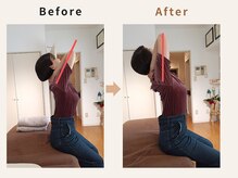 ハリデイズ/30代-背中のハリ、腰痛