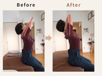 ハリデイズ/30代-背中のハリ、腰痛