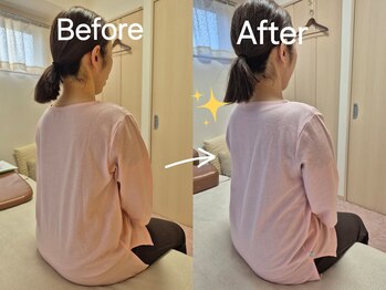 スノー シャイン(SNOW SHINE)/【Before→After】