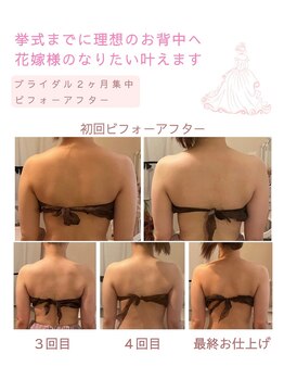 ティアラ(Tiara)/