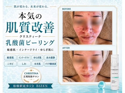 ビゼン(BIZEN)の写真