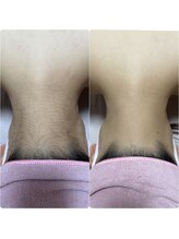 ワイエス サロン 東陽町(Ys Salon)/見えないうなじもキレイに♪