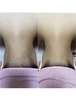 ワイエス サロン 東陽町(Ys Salon)/見えないうなじもキレイに♪