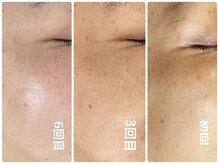 ノーブル シャット Noble Chate/進化するお肌シリーズ