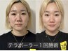 【テラボーラー】小顔・たるみケアに♪当店でテラボーラーがお初めての方
