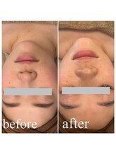 ディス イズ ミー エステティック(This is Me Aesthetic)/小顔&艶肌に