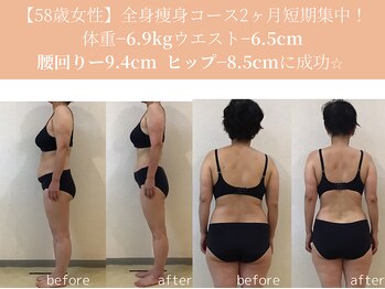 エターナルフレーム(Eternal Flame)/58歳ビフォーアフター