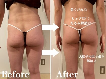 ディオネの写真