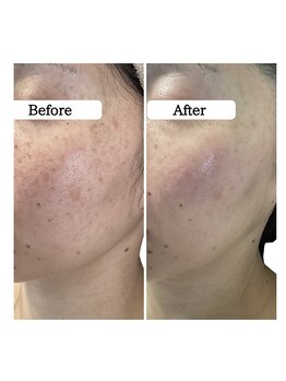 ル ボヌール 伊那店(le bonheur)/エクソソームハーブ　すごい結果