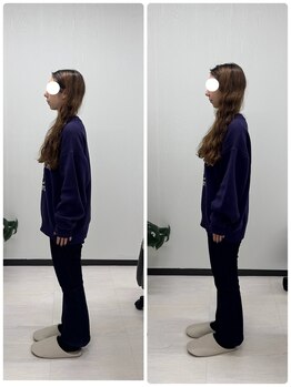 ラフテル鍼灸整骨院/ブライダル整体♪巻き肩改善！