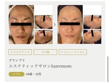 まりも化粧品店/ホワイトスノーピール