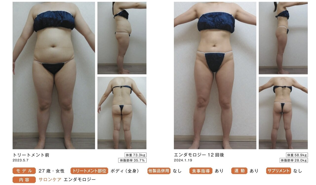 熊本市中央区でエンダモロジーが人気のエステサロン｜ホットペッパー