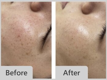 エマクラン(emmaclan)/