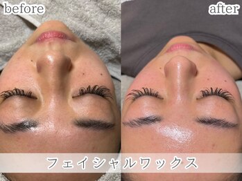 ミック(Mecc)/フェイシャルワックス90分