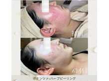 キュキュナチュレの雰囲気（韓国でも大人気のポテンツァが東北に上陸！しつこい肌悩みに最適）