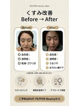 ハイム(HAYIM)/透明感/ほうれい線ケア