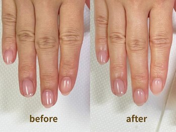 ハンドケア｜手元まで整えるケア