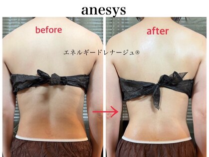 アネシス(anesys)の写真