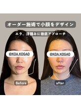 コア 中目黒店(Koa)/お客様ビフォーアフター！！