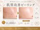 ルチル 八女店(Rutile)の写真/"初めての方にはこのメニューがおすすめ☆"肌悩み別ピーリング《クリスティーナ/韓国肌管理/水光LDM》