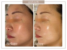 ロイヤル(ROYAL)の雰囲気(ハリツヤ肌を1度で実感◎口コミ多数♪)