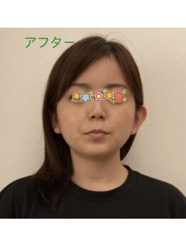 ソレイユ/ケアの後のお写真です