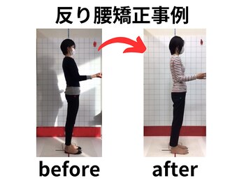 ほねつぎ 平成けやき通り鍼灸接骨院/反り腰改善!