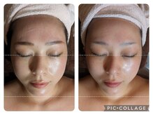 エクラ(eclat)/☆小顔リフトアップメニュー☆