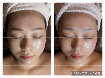 エクラ(eclat)/☆小顔リフトアップメニュー☆