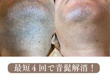 フィーゴ 天満店(FiGO)