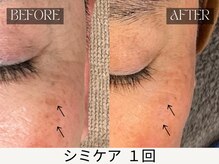 スキンジム(SKIN GYM)/3回程繰り返すとより効果的です