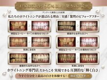 ホワイトニングショップ 越谷せんげん台店