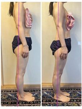 ローズ 下松(ROSE)/【筋膜リリース120分】