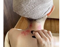 リュクス(Luxe)/首が回りやすい！