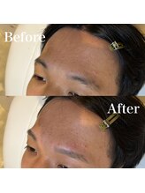 モテテ(motete)/お客様施術例☆栄本店