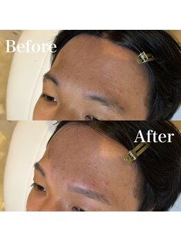 モテテ(motete)/お客様施術例☆栄本店