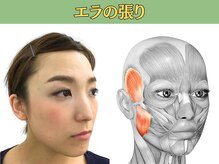 顔が変わる。印象が変わる。根本から導く小顔矯正／左右差・たるみ・輪郭、すべてにアプローチ