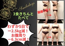 スマイルデイズ(Smiledays)