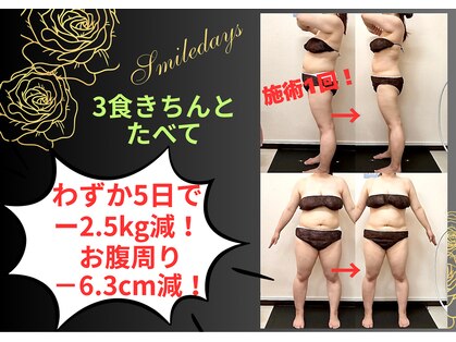 スマイルデイズ(Smiledays)の写真
