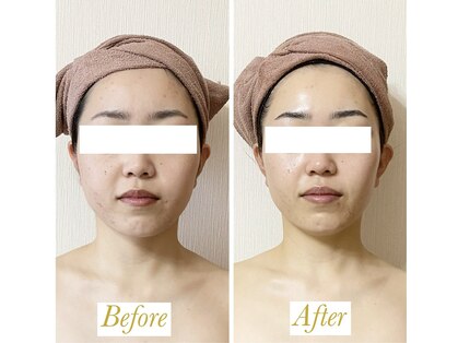 サロンミッシェル(Salon Michel)の写真