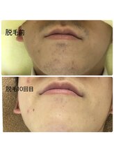 ベルマタン(belle matin)/毎日の手入れが楽に清潔感もUP！