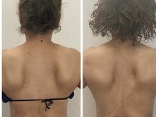 relaxation salon SUNNY &nbsp;【リンパ/肩甲骨剥がし/腸揉み/毛穴洗浄/筋膜リリース】の雰囲気（肩こり改善、肩甲骨の可動域が変わる）