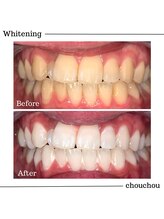 シュシュ(chouchou)/高濃度医療提携機関ジェル比較
