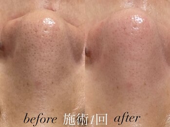 リスポアラボ(LIS PORE.LAB)/