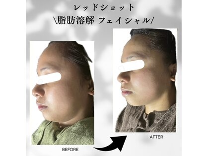 アローナ(ARONA)の写真