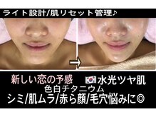 アルページュ(Arpege)/肌改善リフト！リセット管理♪